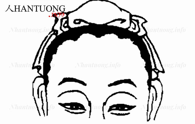 Đường chân tóc ở trước trán tạo thành hình răng cưa Đường chân tóc ở trước trán tạo thành hình răng cưa