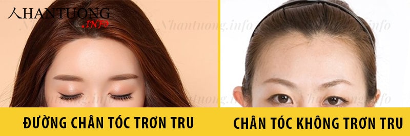 Nhận dạng đường chân tóc lý tưởng Nhận dạng đường chân tóc lý tưởng