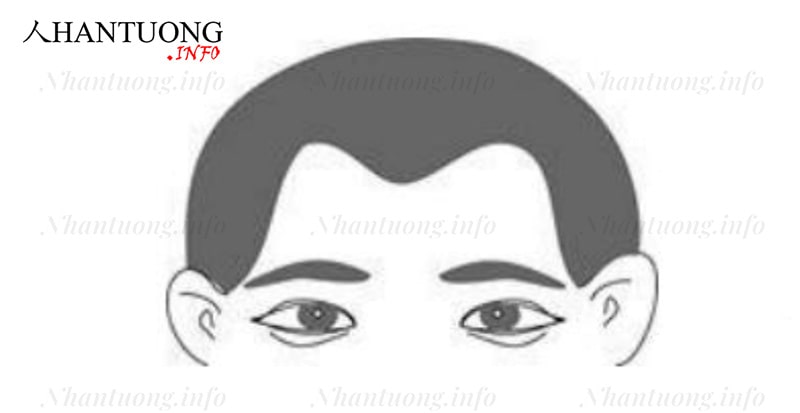 Đàn ông trán đồi Đàn ông trán đồi