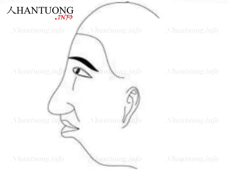 Đàn ông trán lẹm Đàn ông trán lẹm