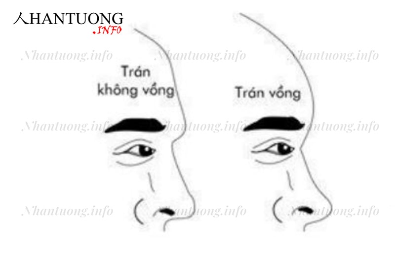 Đàn ông trán vồng Đàn ông trán vồng