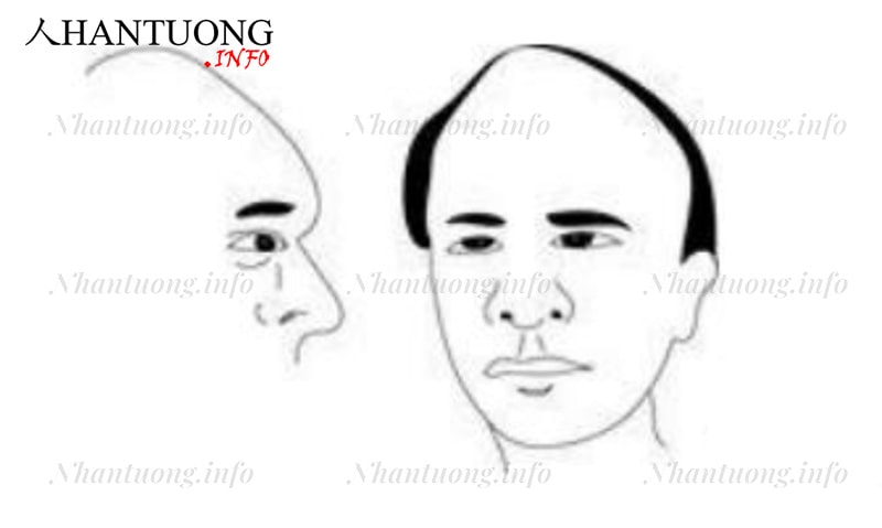 Đàn ông trán vuốt lên Đàn ông trán vuốt lên