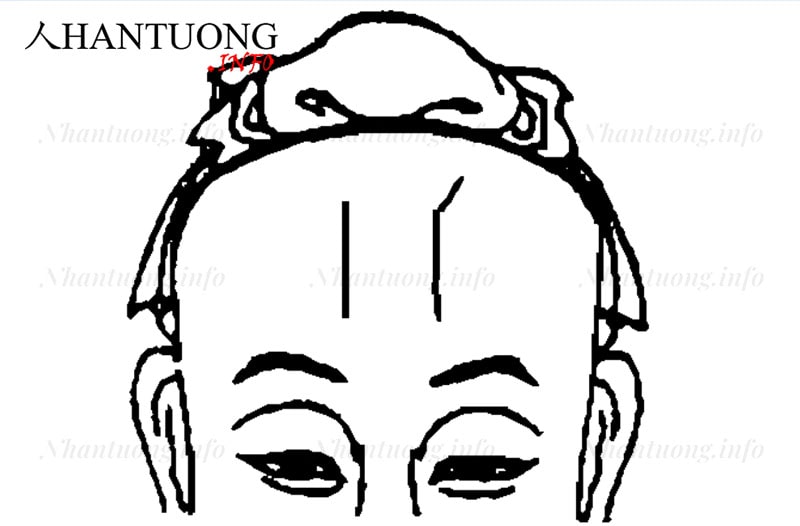 Song trực vân trên trán Song trực vân trên trán