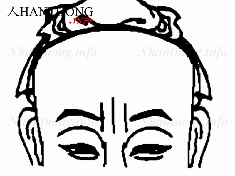 Xuyên tự vân ở ấn đường Xuyên tự vân ở ấn đường