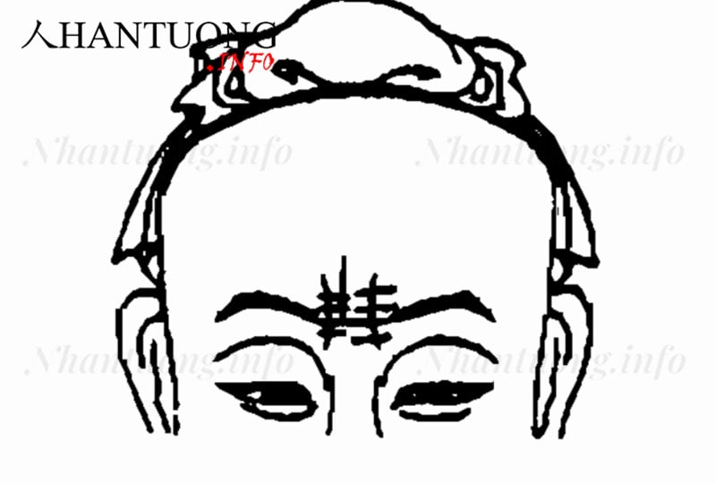 Loạn vân trên Ấn đường Loạn vân trên Ấn đường